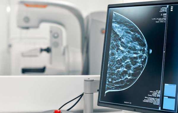 Mammography System Market: Current Status, Opportunities, and Future Prospects
