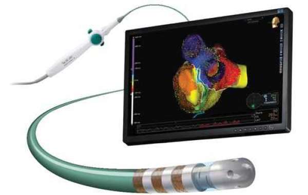 Sensor Based Smart Catheters Market, Analysis Recent Industry Trends And Developments Till 2031