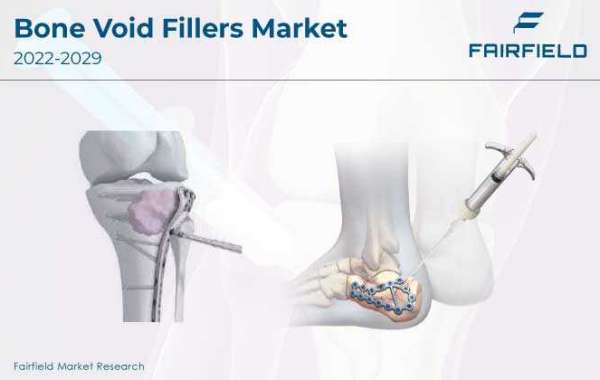 Bone Void Fillers Market Expected to Witness High Growth over the Forecast Period 2022-2029