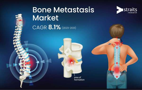 Bone Metastasis  Industry Report: Global Market Manufacturers, Outlook and Growth till forecast